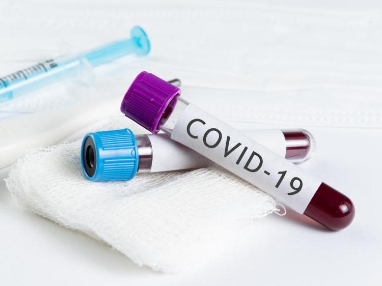 Игорь Кобзев: Необходимо усилить контроль лечения и состояния амбулаторных пациентов с COVID-19